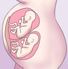 многоплодная беременность 