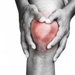 Характеристики артрита коленного сустава: симптомы и лечение
