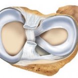 Виды повреждений капсульно-связочного аппарата коленного сустава